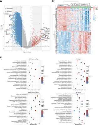 Machine learning-based transcriptome analysis of lipid metabolism biomarkers for the survival prediction in hepatocellular carcinoma